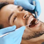Importancia de una limpieza dental después de Semana Santa