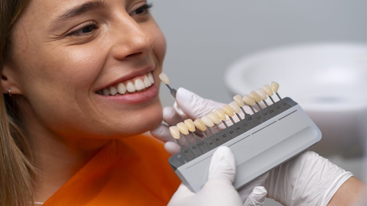 Quiénes son candidatos ideales para implantes dentales