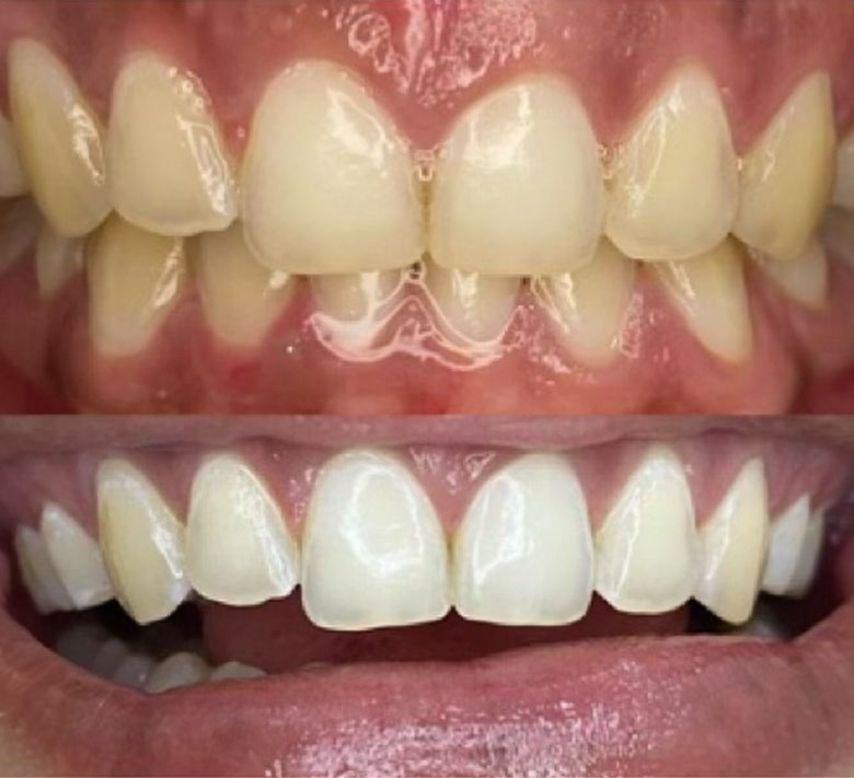Odontologia estetica en Santo Domingo